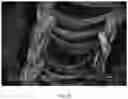 Fig. 09 - Composite scaffold for the repair, reconstruction, and regeneration of soft tissues