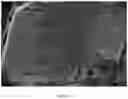 Fig. 16 - Composite scaffold for the repair, reconstruction, and regeneration of soft tissues