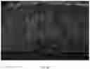 Fig. 17 - Composite scaffold for the repair, reconstruction, and regeneration of soft tissues