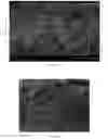 Fig. 20 - Composite scaffold for the repair, reconstruction, and regeneration of soft tissues