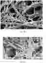 Fig. 22 - Composite scaffold for the repair, reconstruction, and regeneration of soft tissues