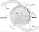 Fig. 01 - Intraocular lenses