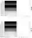 Fig. 12 - Intraocular lenses