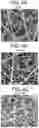 Fig. 05 - Prosthetic valves and related inventions