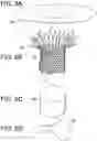 Fig. 06 - Prosthetic valves and related inventions