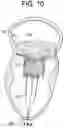 Fig. 12 - Prosthetic valves and related inventions