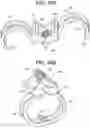 Fig. 32 - Prosthetic valves and related inventions