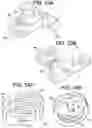 Fig. 34 - Prosthetic valves and related inventions