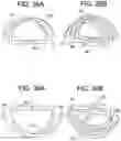 Fig. 35 - Prosthetic valves and related inventions