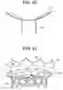Fig. 38 - Prosthetic valves and related inventions