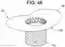 Fig. 43 - Prosthetic valves and related inventions