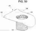 Fig. 45 - Prosthetic valves and related inventions