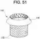 Fig. 46 - Prosthetic valves and related inventions