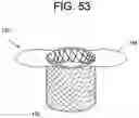 Fig. 48 - Prosthetic valves and related inventions