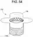 Fig. 49 - Prosthetic valves and related inventions