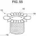 Fig. 50 - Prosthetic valves and related inventions