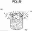Fig. 51 - Prosthetic valves and related inventions