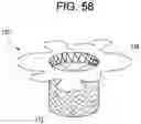 Fig. 53 - Prosthetic valves and related inventions