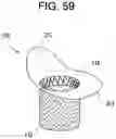 Fig. 54 - Prosthetic valves and related inventions