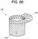 Fig. 55 - Prosthetic valves and related inventions