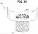 Fig. 56 - Prosthetic valves and related inventions