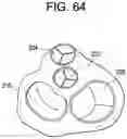 Fig. 59 - Prosthetic valves and related inventions