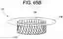Fig. 61 - Prosthetic valves and related inventions