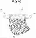 Fig. 62 - Prosthetic valves and related inventions