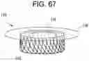 Fig. 63 - Prosthetic valves and related inventions