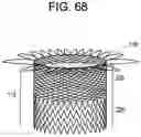 Fig. 64 - Prosthetic valves and related inventions