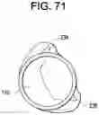 Fig. 67 - Prosthetic valves and related inventions