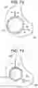 Fig. 68 - Prosthetic valves and related inventions
