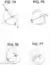 Fig. 69 - Prosthetic valves and related inventions