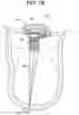 Fig. 70 - Prosthetic valves and related inventions
