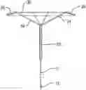 Fig. 01 - Implantable transcatheter intracardiac devices and methods for treating incompetent atrioventricular valves