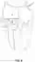 Fig. 09 - Implantable transcatheter intracardiac devices and methods for treating incompetent atrioventricular valves