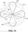 Fig. 15 - Implantable transcatheter intracardiac devices and methods for treating incompetent atrioventricular valves