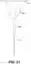 Fig. 20 - Implantable transcatheter intracardiac devices and methods for treating incompetent atrioventricular valves