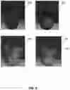 Fig. 03 - METHODS TO IMPROVE THE DURABILITY OF POLYMERIC HEART VALVES