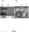 Fig. 12 - METHODS TO IMPROVE THE DURABILITY OF POLYMERIC HEART VALVES