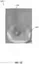 Fig. 14 - METHODS TO IMPROVE THE DURABILITY OF POLYMERIC HEART VALVES