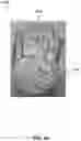 Fig. 17 - METHODS TO IMPROVE THE DURABILITY OF POLYMERIC HEART VALVES