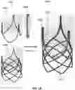 Fig. 20 - METHODS TO IMPROVE THE DURABILITY OF POLYMERIC HEART VALVES