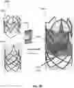 Fig. 21 - METHODS TO IMPROVE THE DURABILITY OF POLYMERIC HEART VALVES