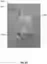 Fig. 23 - METHODS TO IMPROVE THE DURABILITY OF POLYMERIC HEART VALVES
