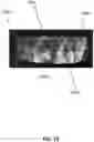 Fig. 24 - METHODS TO IMPROVE THE DURABILITY OF POLYMERIC HEART VALVES