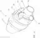 Fig. 08 - STENT VALVE, DELIVERY APPARATUS AND METHOD THEREFOR