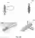 Fig. 08 - IMPLANTABLE ELECTROMAGNETIC FIELD GENERATOR FOR ORTHOPEDIC THERAPY