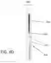 Fig. 10 - IMPLANTABLE ELECTROMAGNETIC FIELD GENERATOR FOR ORTHOPEDIC THERAPY