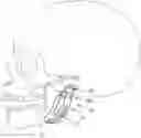 Fig. 01 - Temporomandibular joint prosthesis